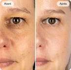 Appareil Lifting 3 en 1 : Peau ferme & éclat naturel
